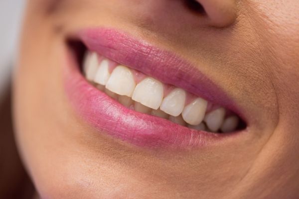 womans mouth showing uneven teeth